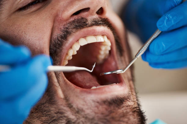 Best Emergency Gum Pain Relief  in Allendale, SC